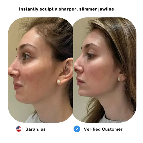 ELMILANA EMS Glow Lift Device – Face & Neck Firming Microcurrent Massager