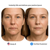 ELMILANA  BEAUTY  LIFT  DEVICE