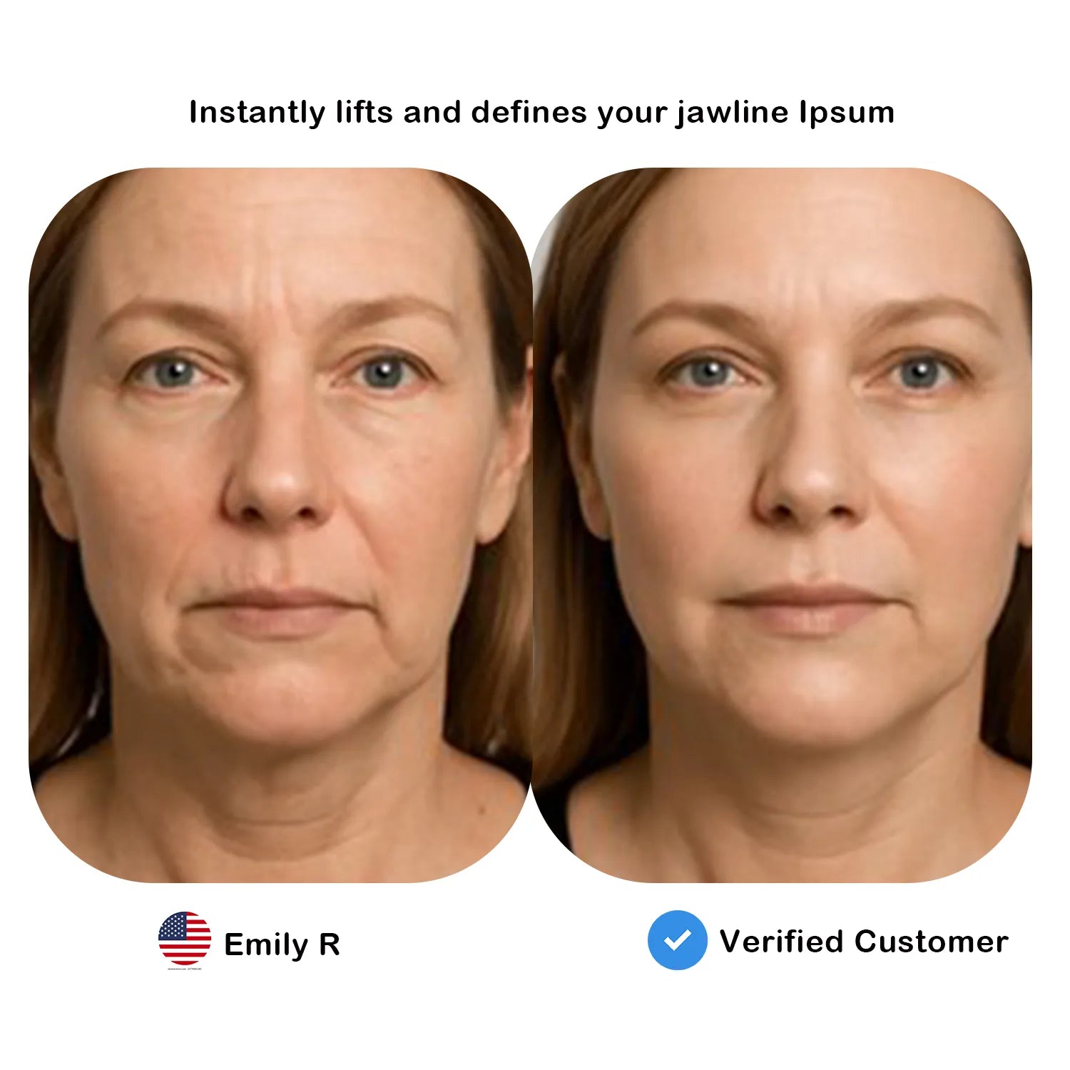 ELMILANA  BEAUTY  LIFT  DEVICE