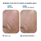 Elmilana Vitamin C Skin Brightening Serum