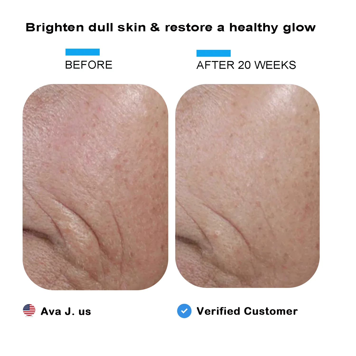 Elmilana Vitamin C Skin Brightening Serum