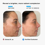 Elmilana Skin Brightening Serum