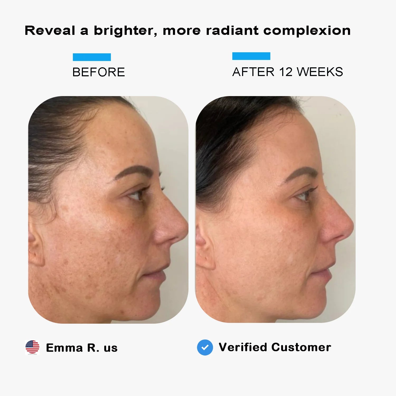 Elmilana Skin Brightening Serum