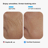 Elmilana Collagen Repair Cream