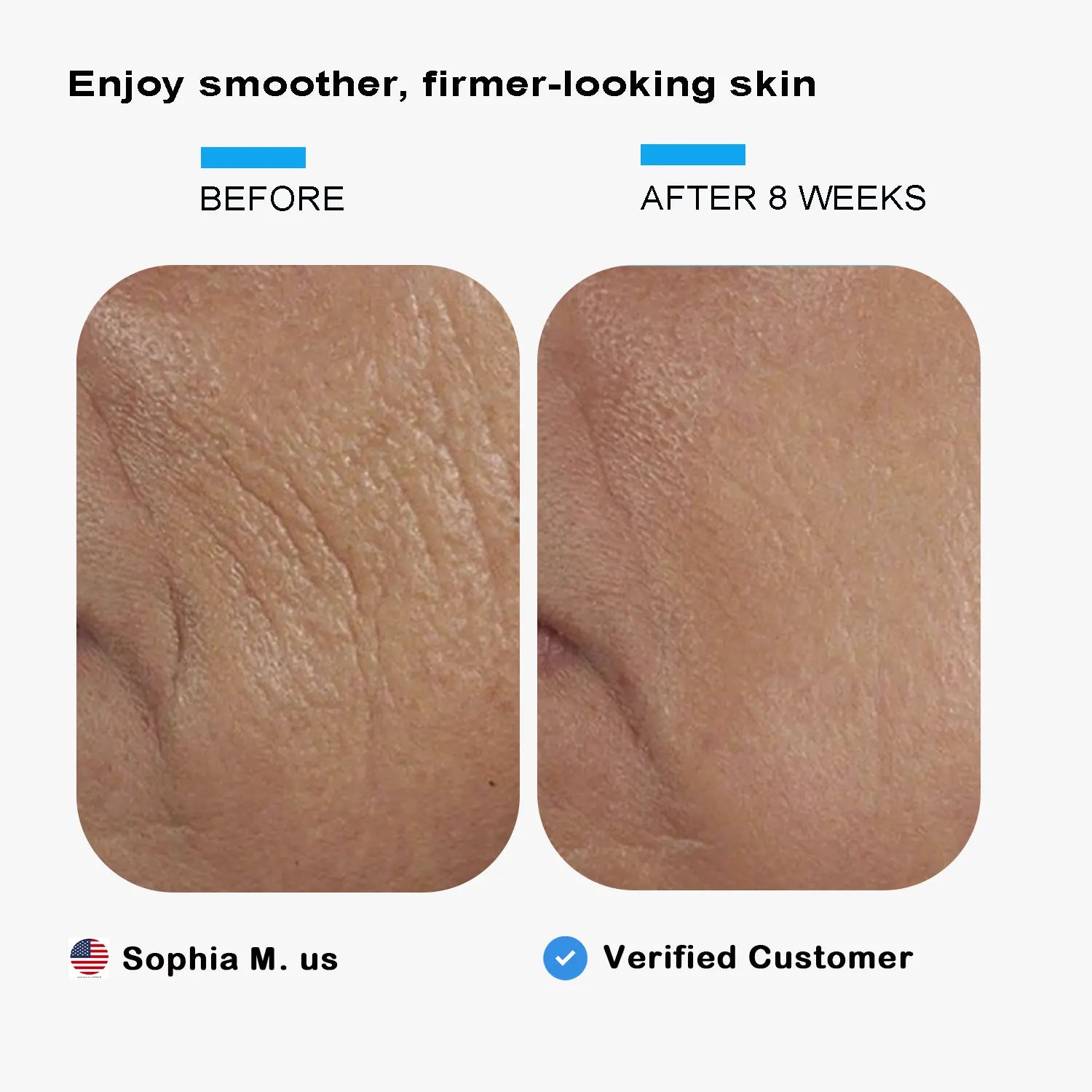 Elmilana Collagen Repair Cream