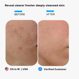 ELMILANA Sonic Thermal Facial Cleansing & Lifting Device