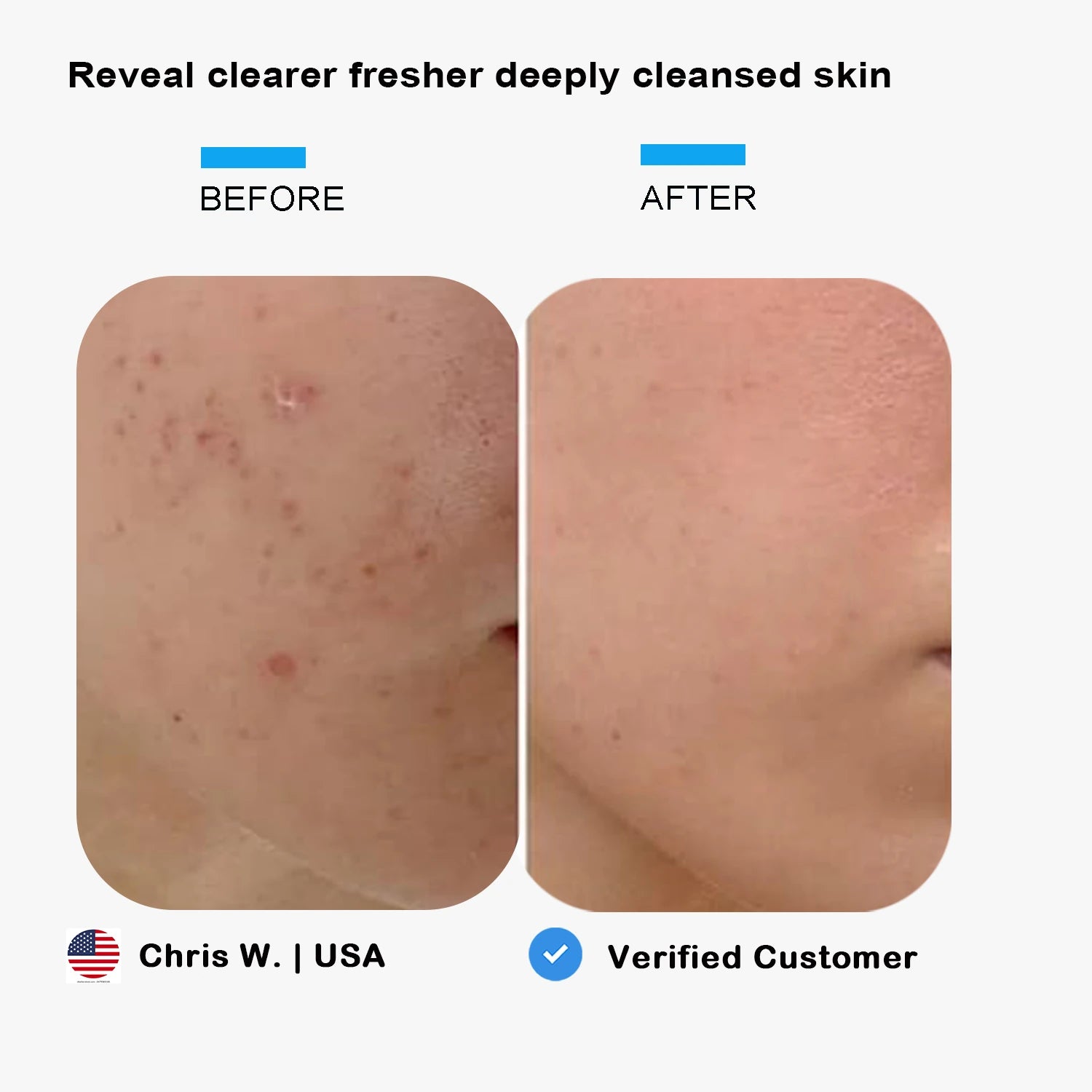 ELMILANA Sonic Thermal Facial Cleansing & Lifting Device